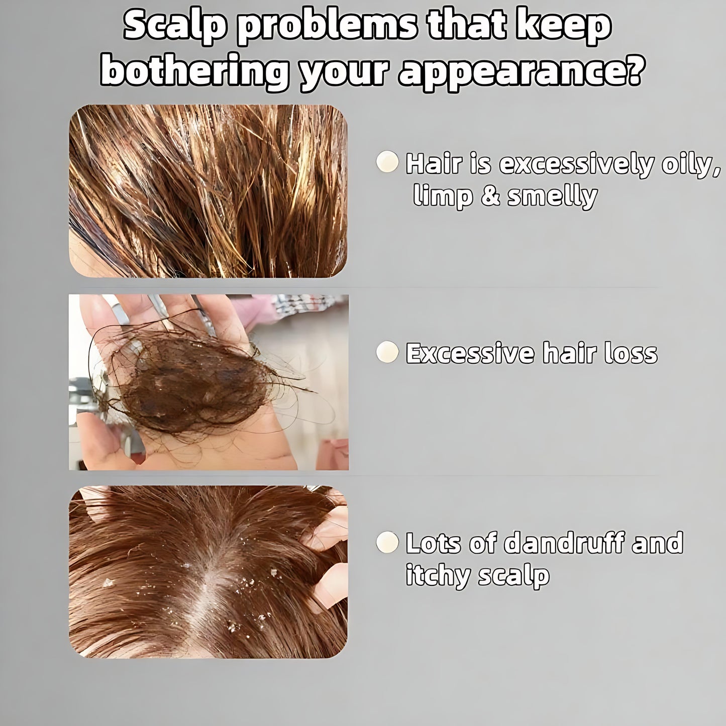 【Buy 1 Get 1 Free】REMIMPI Anti-Hair Fall Hair Loss Treatment Shampoo Oil Control Anti dandruff Haircare Ginseng Ginger Help Hair Growth Jojoba Oat Repair Reduce Hair Loss Scalp Cleanser Conditioner 300ML