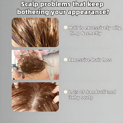 【Buy 1 Get 1 Free】REMIMPI Anti-Hair Fall Hair Loss Treatment Shampoo Oil Control Anti dandruff Haircare Ginseng Ginger Help Hair Growth Jojoba Oat Repair Reduce Hair Loss Scalp Cleanser Conditioner 300ML